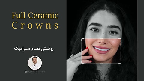 ویدئو روکش تمام سرامیک