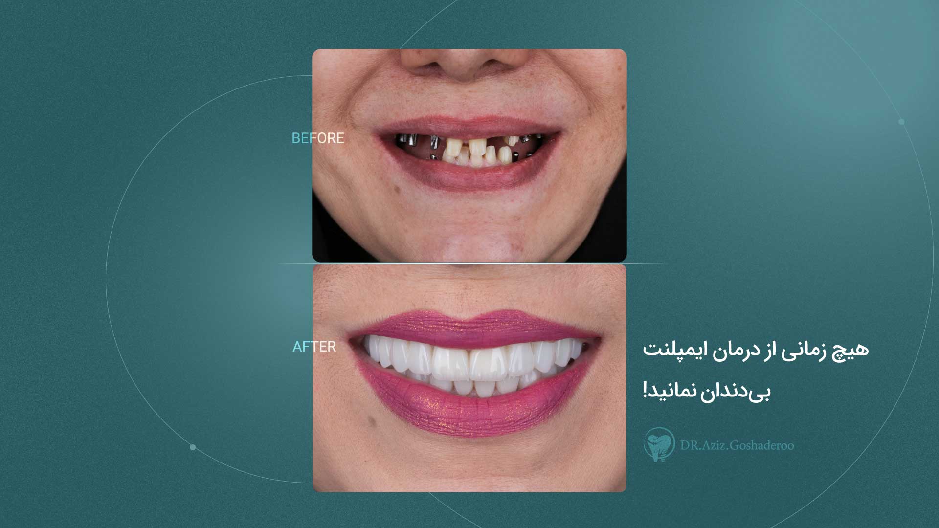 Klaas - Dentist website Webflow template