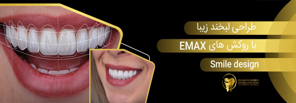 دندانپزشکی زیبایی