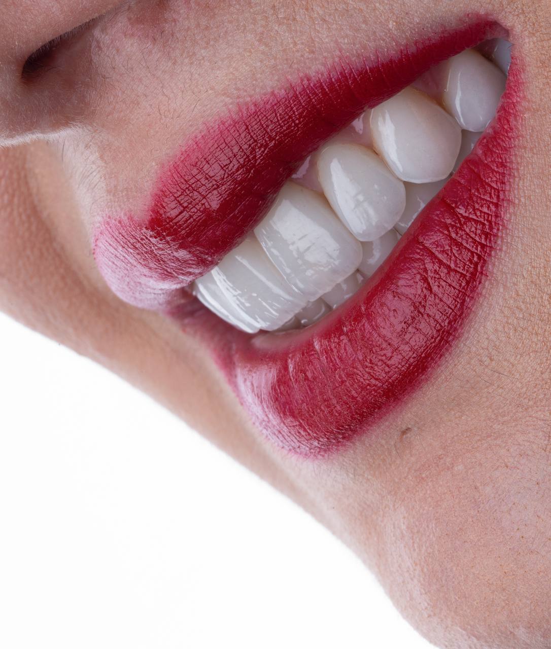 خدمات VIP ایمپلنت دندان