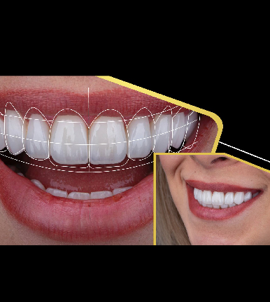 خدمات VIP دندان پزشکی زیبایی