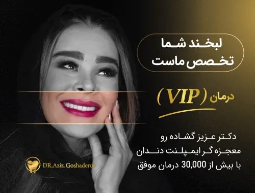 مرکز ایمپلنت دندان در تهران