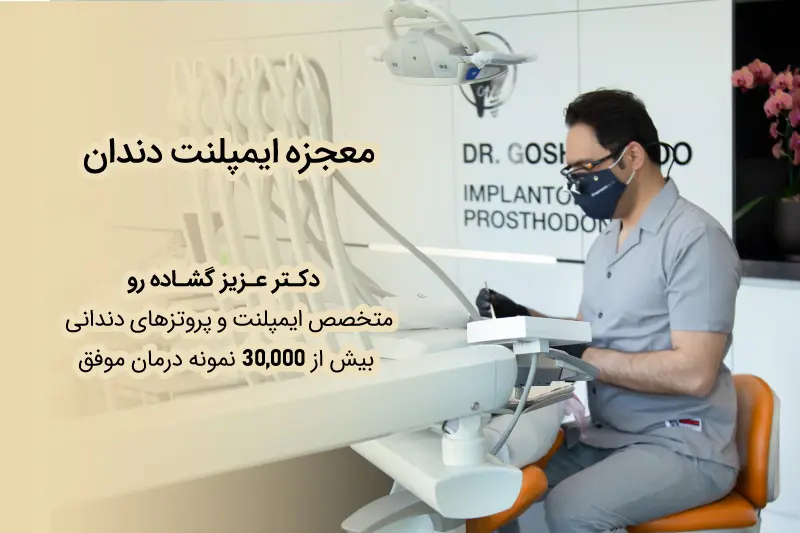 متخصص ایمپلنت دندان در تهران