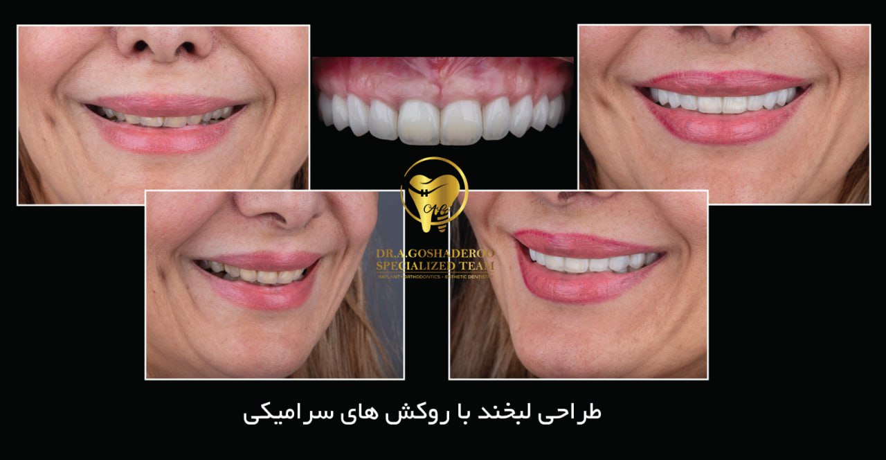 دندانپزشکی زیبایی