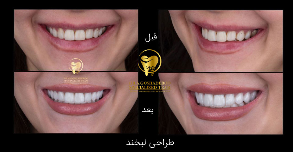 دندانپزشکی زیبایی