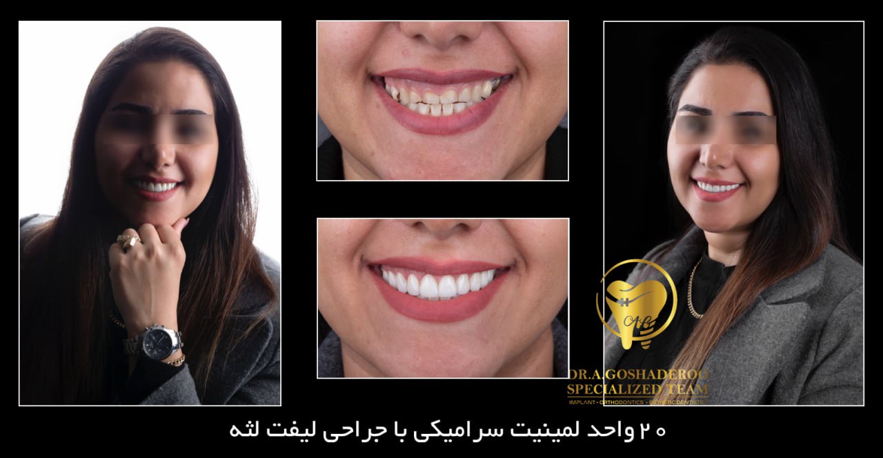 دندانپزشکی زیبایی