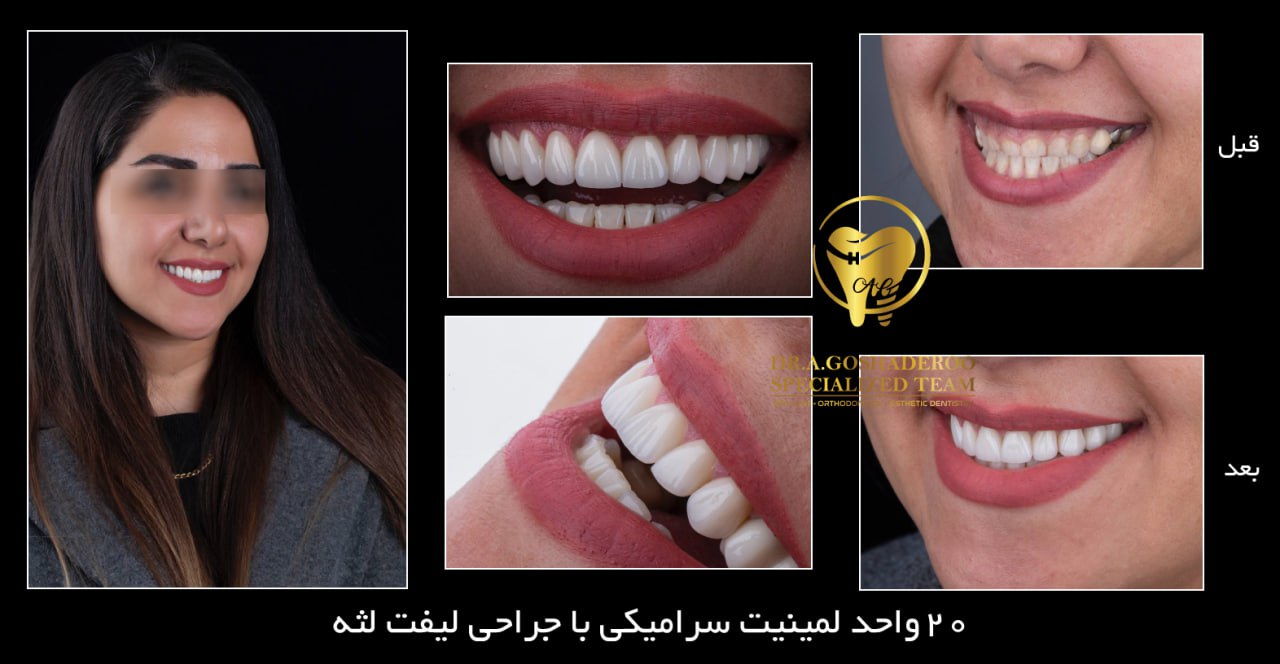 دندانپزشکی زیبایی