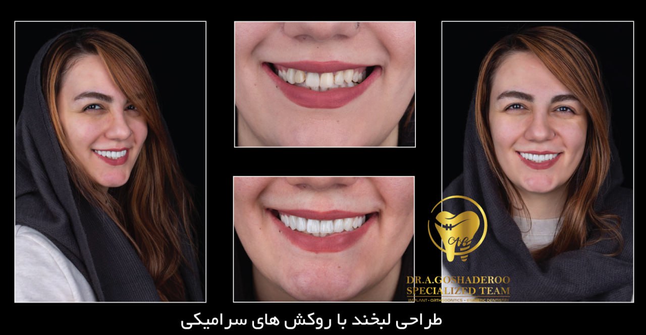 دندانپزشکی زیبایی