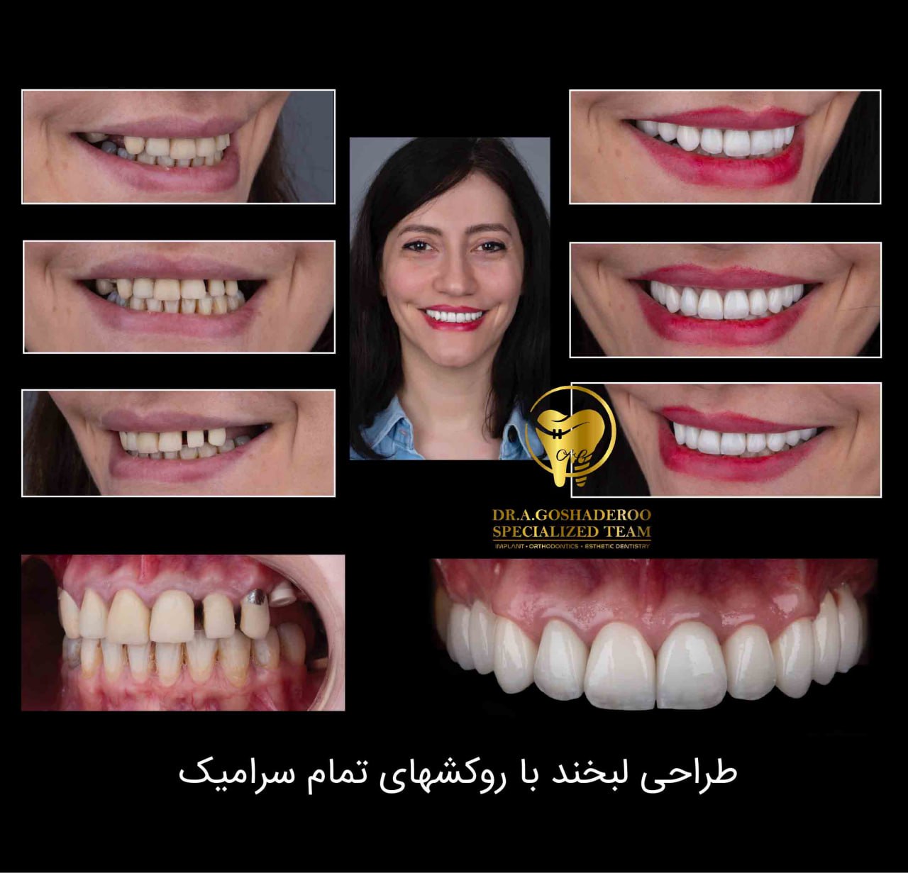 دندانپزشکی زیبایی