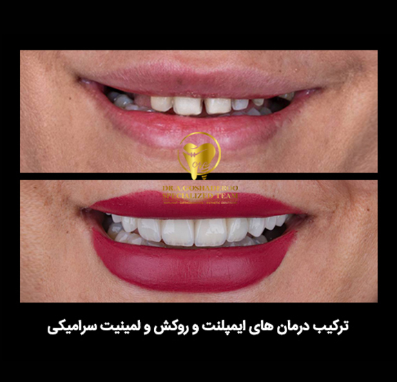 دندانپزشکی زیبایی