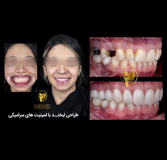 دندانپزشکی زیبایی