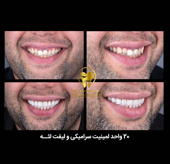 دندانپزشکی زیبایی