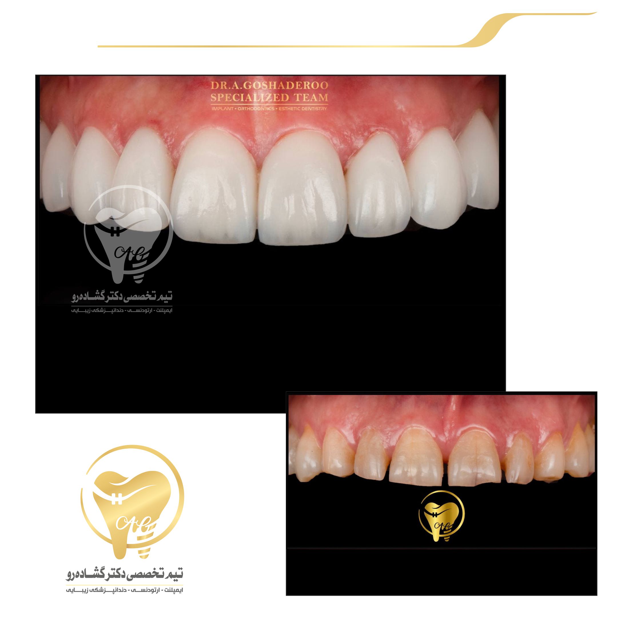 دندانپزشکی زیبایی