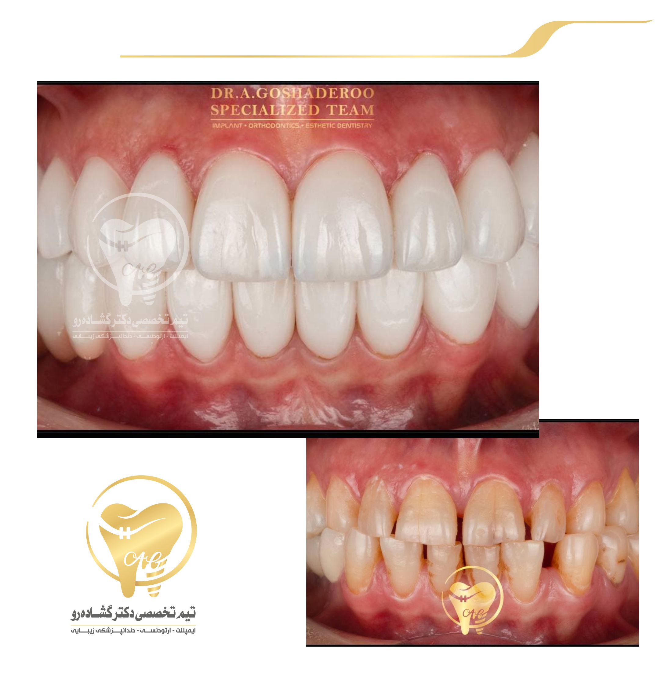 دندانپزشکی زیبایی