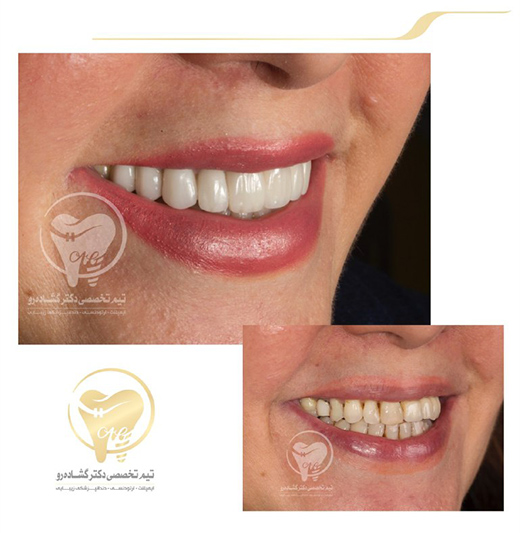 دندانپزشکی زیبایی