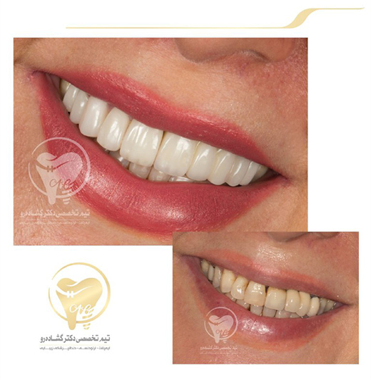 دندانپزشکی زیبایی