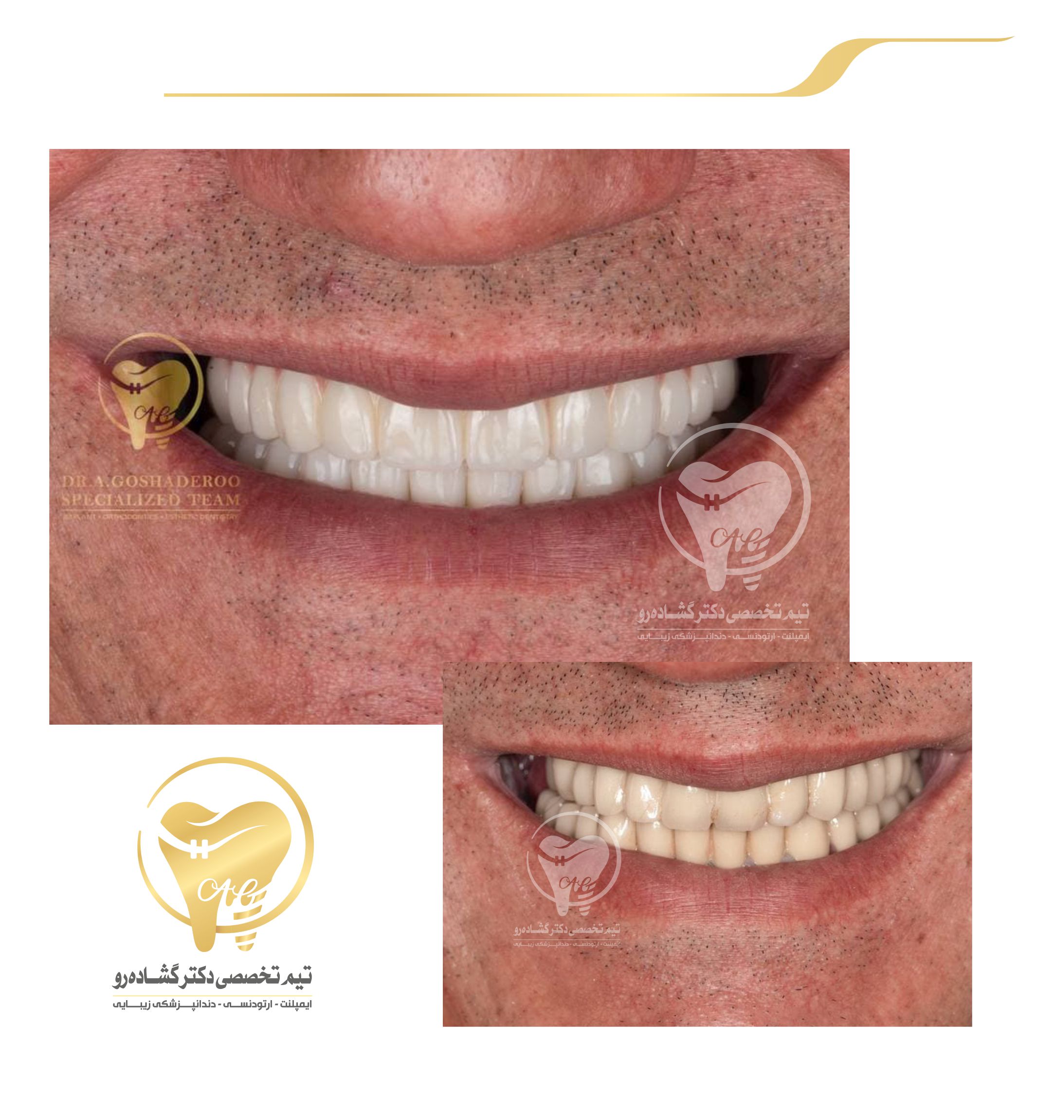 دندانپزشکی زیبایی