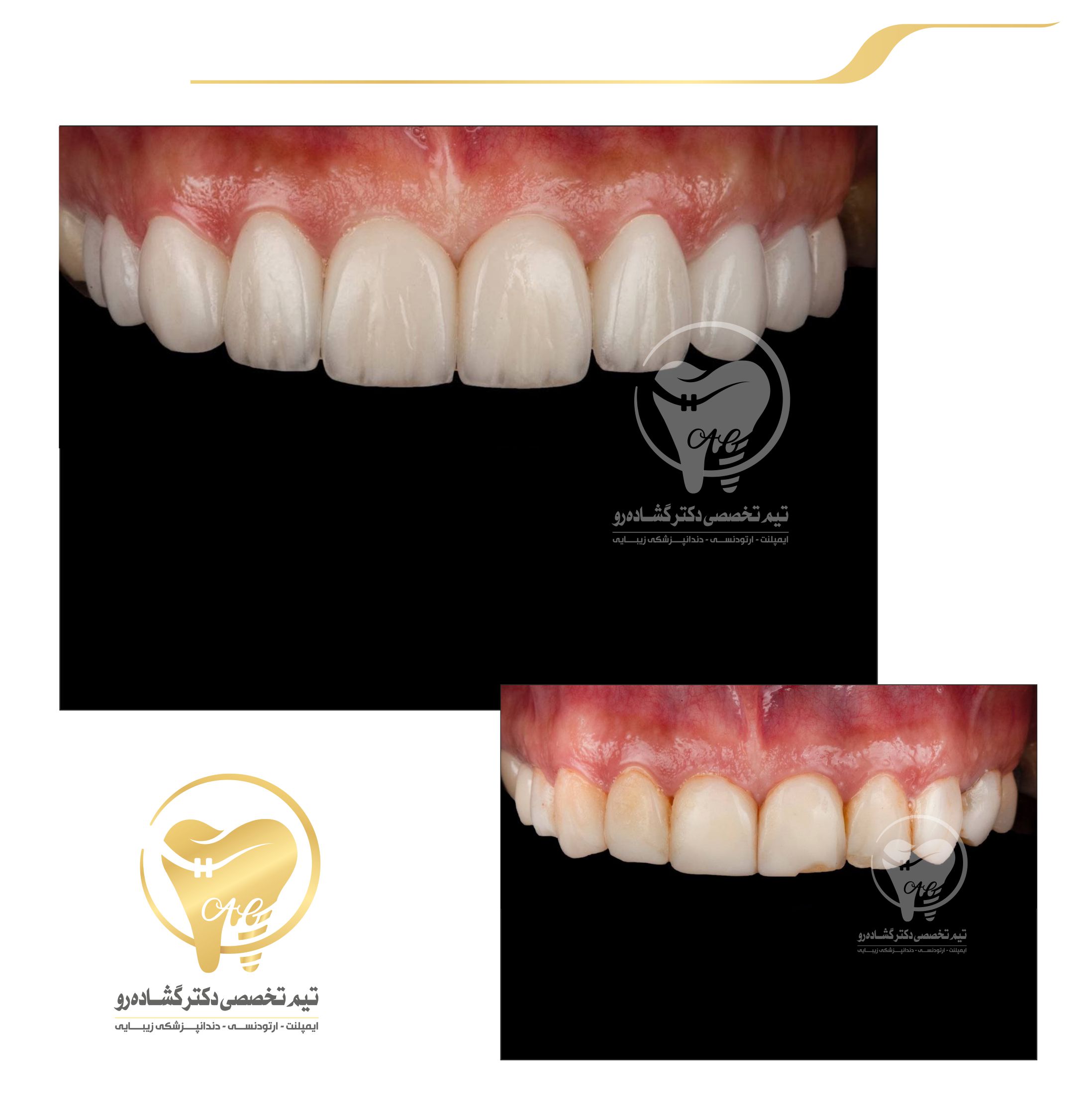 دندانپزشکی زیبایی