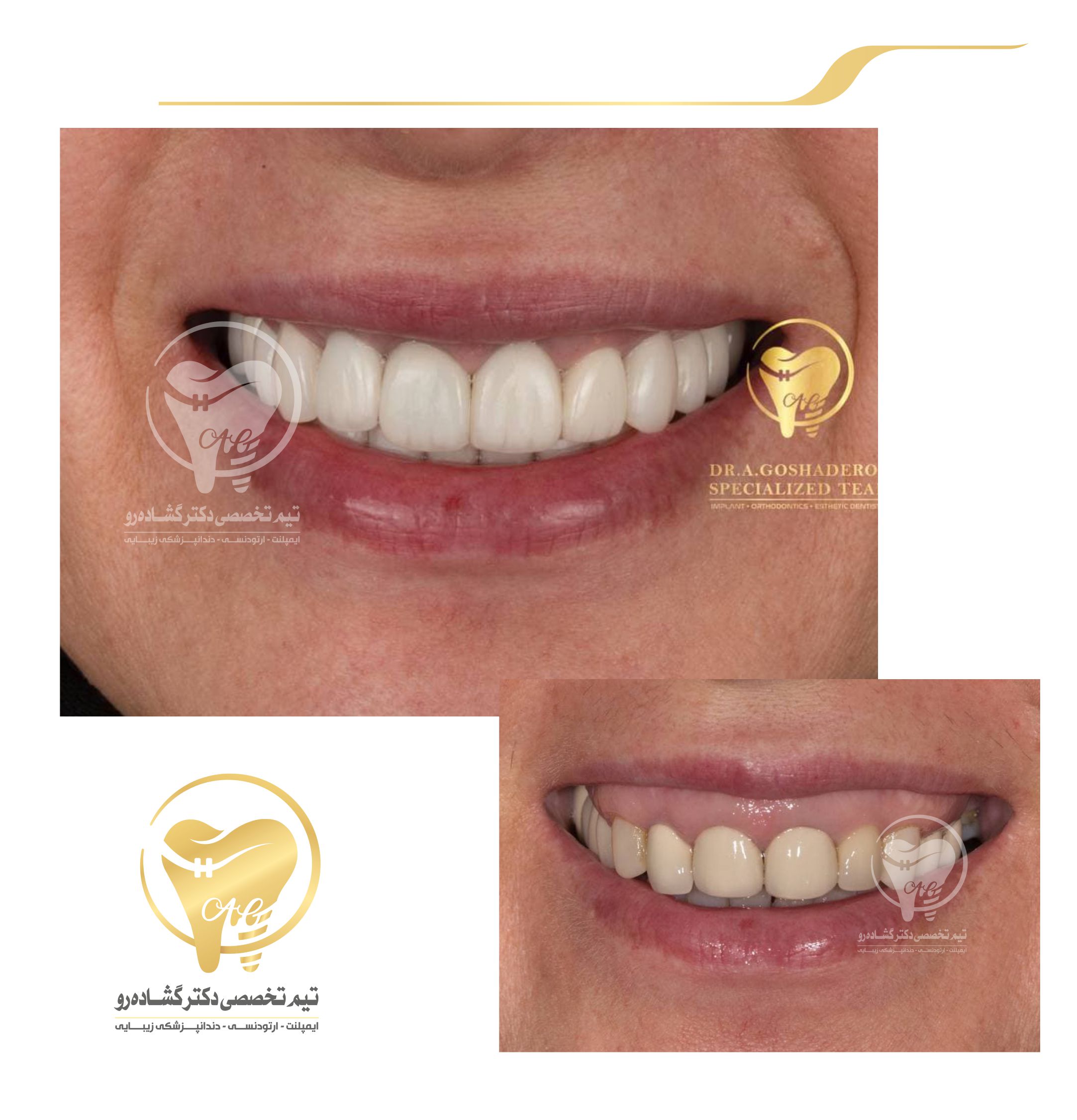 دندانپزشکی زیبایی