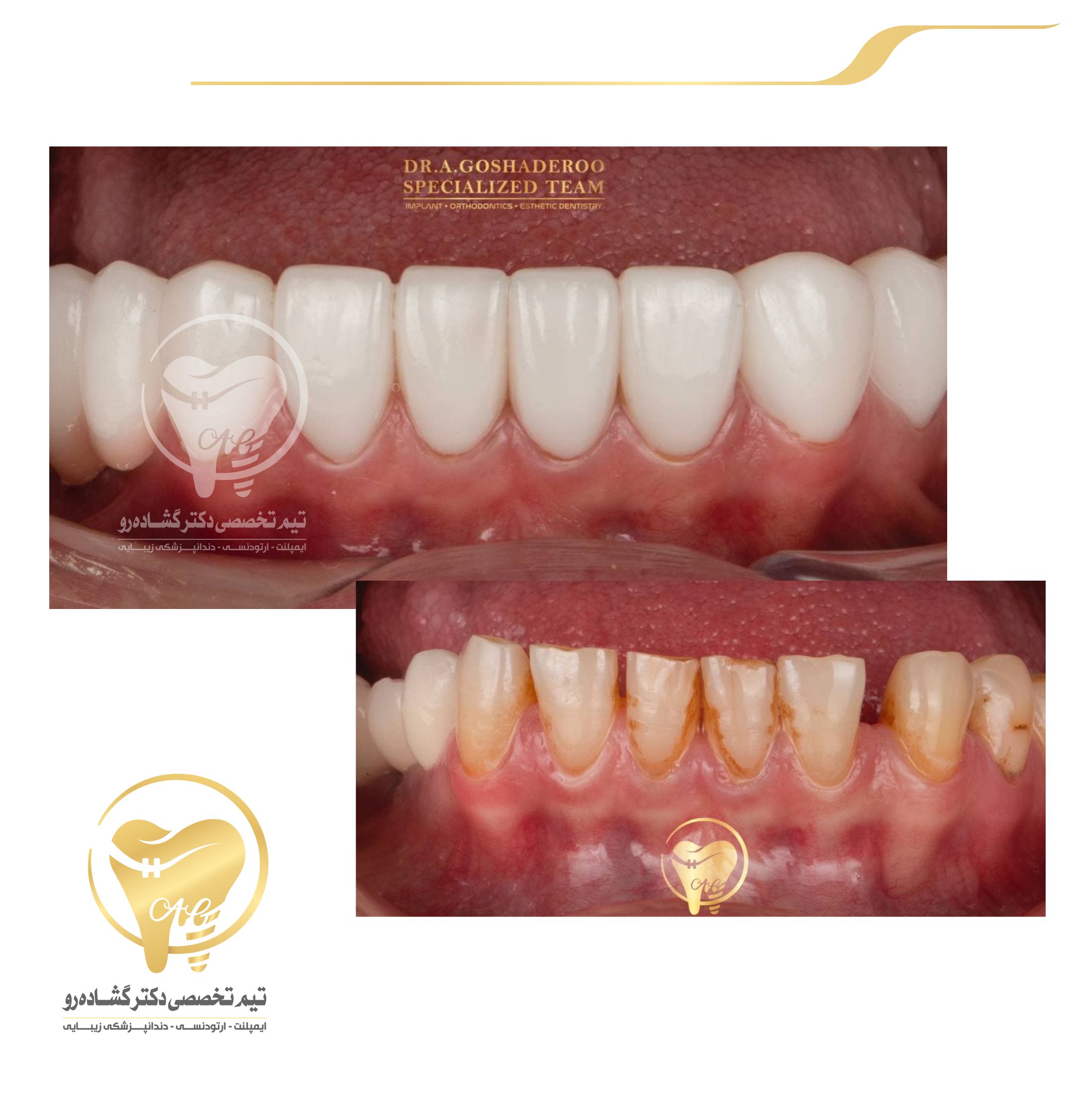 دندانپزشکی زیبایی