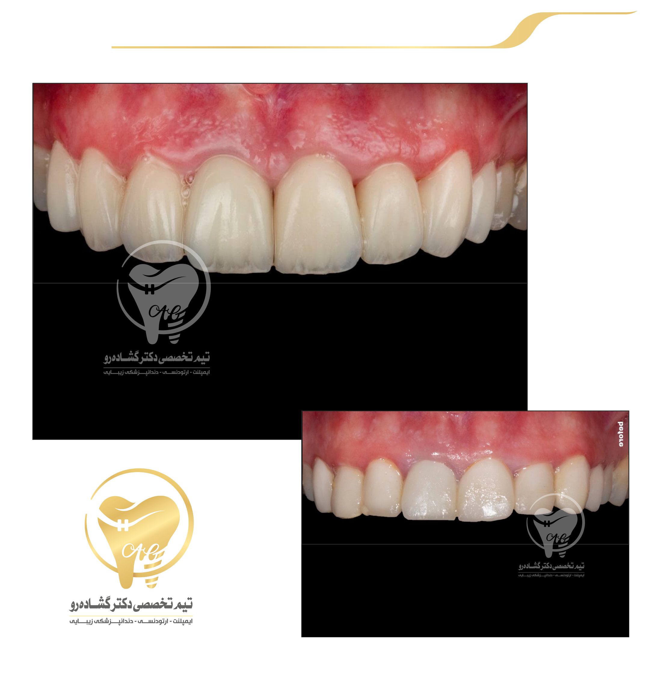 دندانپزشکی زیبایی