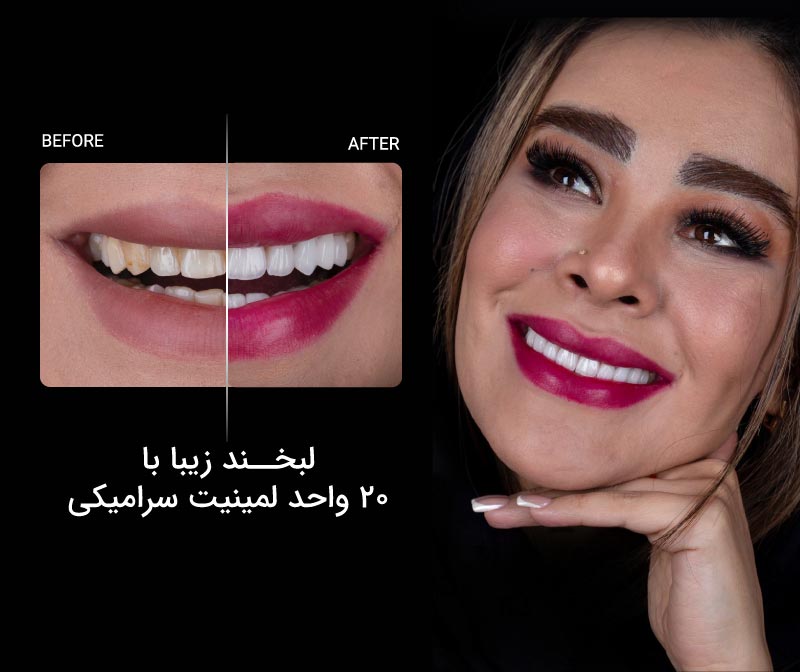 دندانپزشکی زیبایی