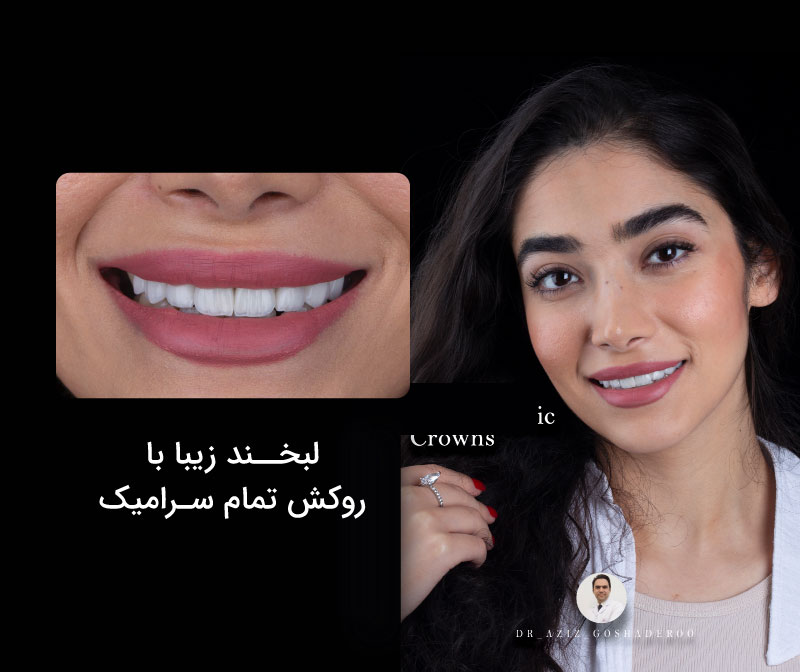 دندانپزشکی زیبایی