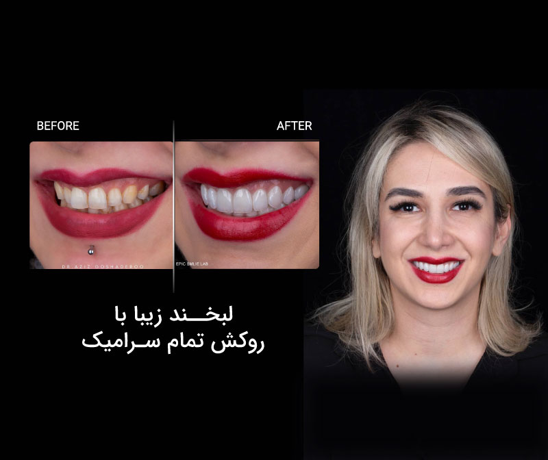 دندانپزشکی زیبایی