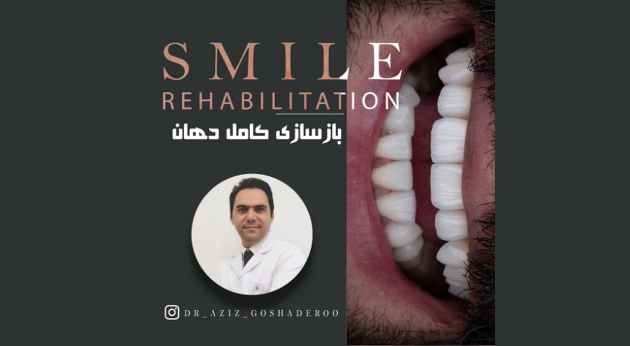 بازسازی کامل دهان | فیلم