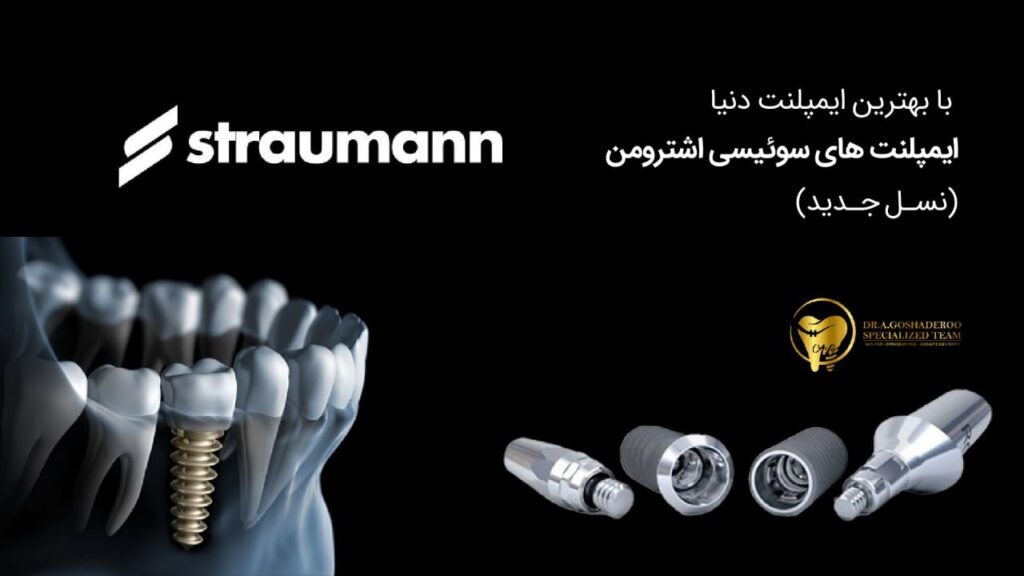 بهترین برندهای ایمپلنت دنیا