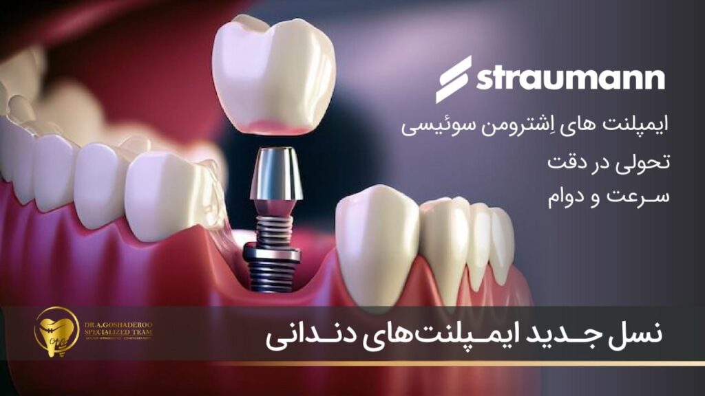 بهترین برند ایمپلنت دنیا