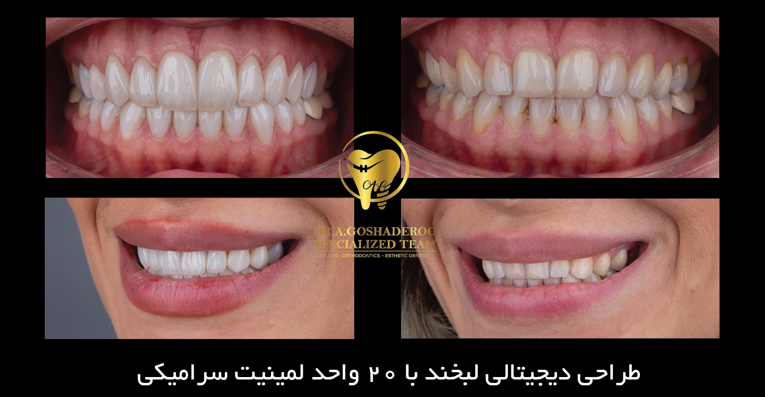 دندانپزشکی زیبایی