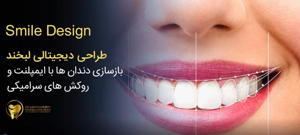 طراحی دیجیتالی لبخند