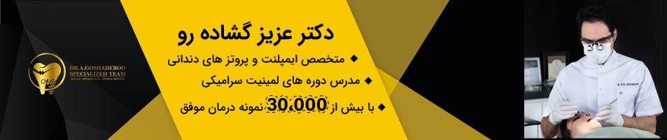 ایمپلنت یک روزه