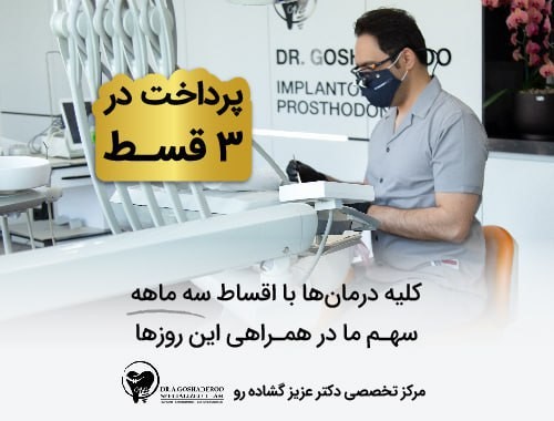 پرداخت قسطی ایمپلنت