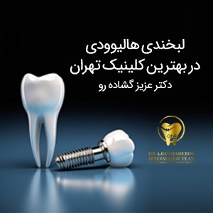 لبخندی هالیوودی در بهترین کلینیک تهران _ دکتر عزیز گشاده رو