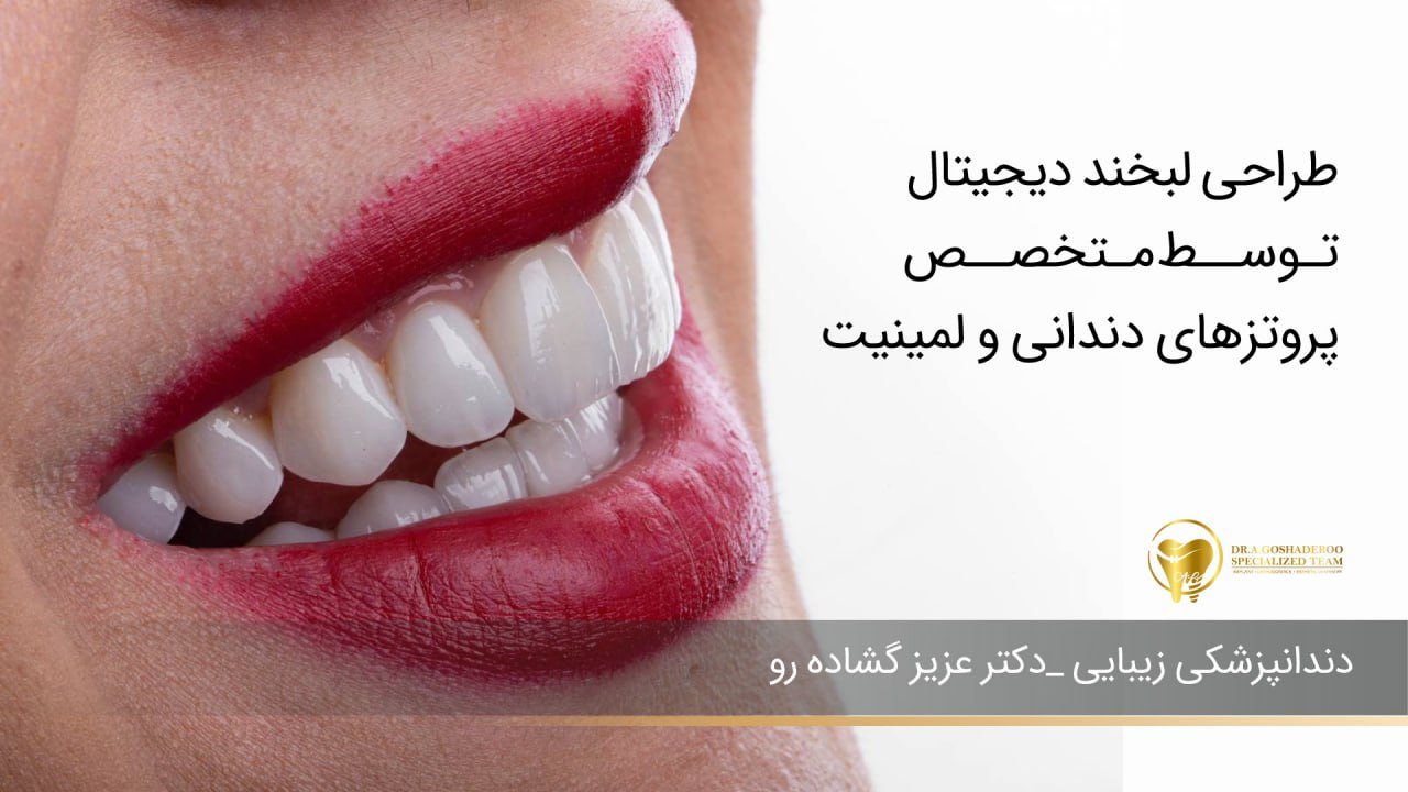 طراحی لبخند دیجیتال توسط متخصص پروتز دندانی و لمینت — مزایا و روند کامل
