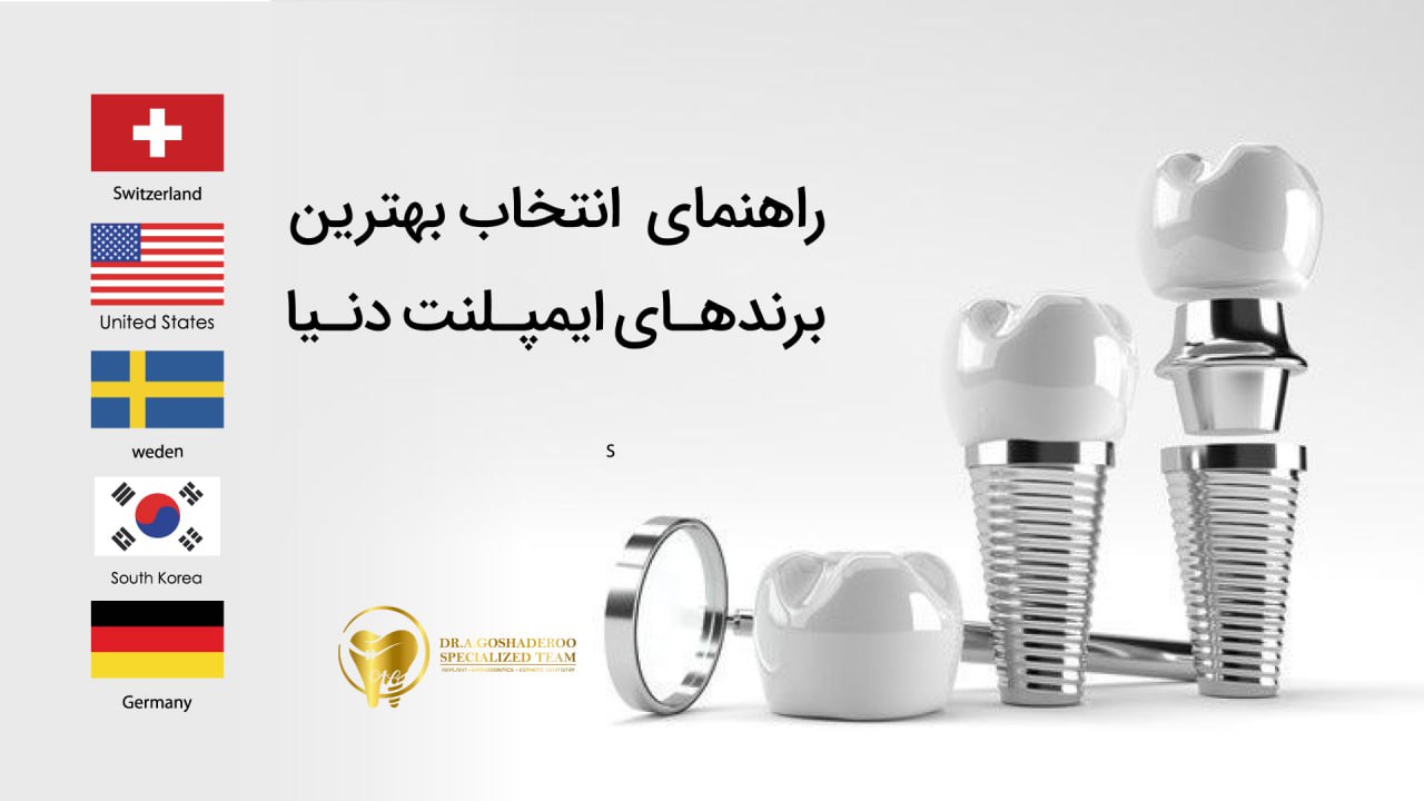 بهترین برندهای ایمپلنت دنیا: راهنمای کامل انتخاب ایمپلنت مناسب