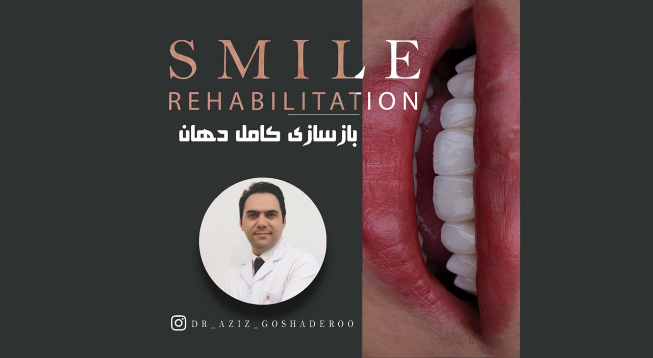 بازسازی لبخند با درمان های ترکیبی _ دکتر عزیز گشاده رو