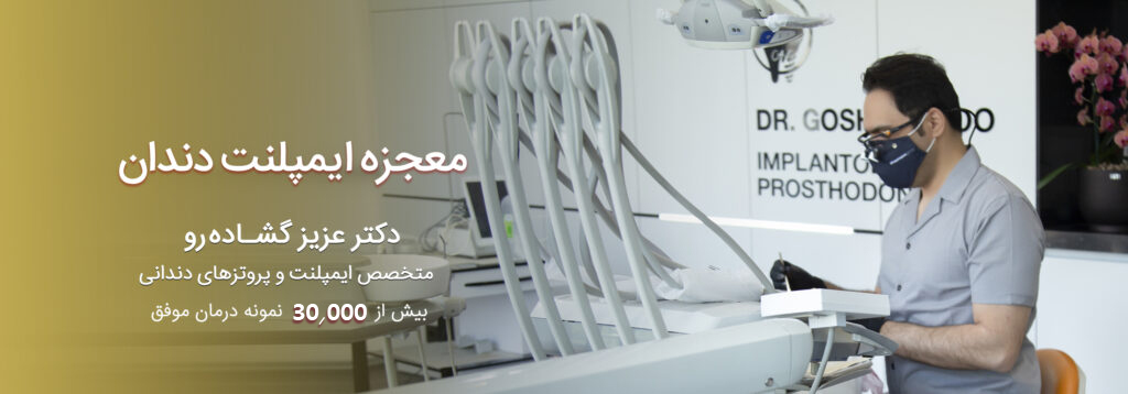 معجزه-ایمپلنت-1-1024x